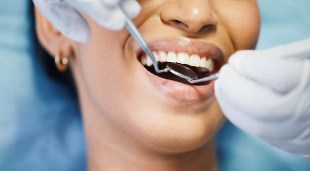 Best Broken or Chipped Tooth Repair in Lodi, CA